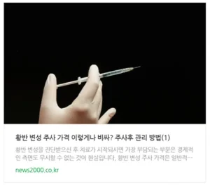 황반변성 주가제 가격