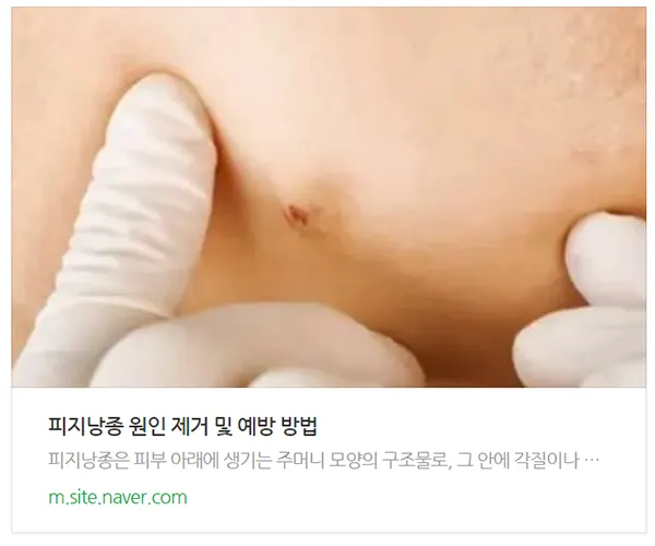 피지낭종